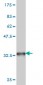 TOP1 Antibody (monoclonal) (M01)