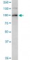 TOP1 Antibody (monoclonal) (M01)