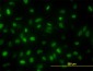 TOP2A Antibody (monoclonal) (M01)