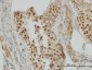 TOP2A Antibody (monoclonal) (M01)