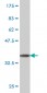 TOP2A Antibody (monoclonal) (M01)