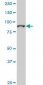 TOP3B Antibody (monoclonal) (M01)