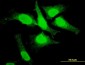 TOP3B Antibody (monoclonal) (M05)