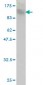 TOP3B Antibody (monoclonal) (M05)