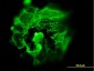 TP53 Antibody (monoclonal) (M01)