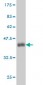 TP53 Antibody (monoclonal) (M01)