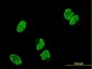 TP53RK Antibody (monoclonal) (M06)