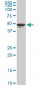 TPBG Antibody (monoclonal) (M09)