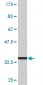 TPD52 Antibody (monoclonal) (M01)