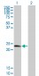 TPD52 Antibody (monoclonal) (M01)
