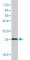 TPI1 Antibody (monoclonal) (M01)