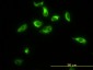 TPMT Antibody (monoclonal) (M01)