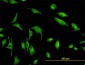 TPMT Antibody (monoclonal) (M02)