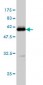 TPMT Antibody (monoclonal) (M02)