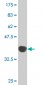 TPO Antibody (monoclonal) (M08)