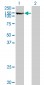 TPO Antibody (monoclonal) (M08)