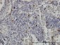 TPSAB1 Antibody (monoclonal) (M01)