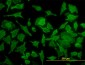 TPT1 Antibody (monoclonal) (M01)