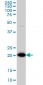 TPT1 Antibody (monoclonal) (M01)