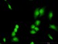 TRADD Antibody (monoclonal) (M01)