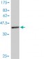 TRAPPC2 Antibody (monoclonal) (M01)