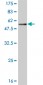 TREM1 Antibody (monoclonal) (M01)