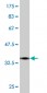 TRIB2 Antibody (monoclonal) (M04)