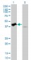 TRIB2 Antibody (monoclonal) (M04)
