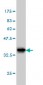 TRIB3 Antibody (monoclonal) (M03)