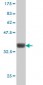 TRIB3 Antibody (monoclonal) (M06)