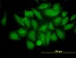 TRIM25 Antibody (monoclonal) (M03)