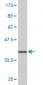 TRIM25 Antibody (monoclonal) (M03)