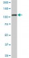 TRIM28 Antibody (monoclonal) (M01)