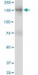 TRIM33 Antibody (monoclonal) (M01)