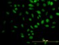 TRIM33 Antibody (monoclonal) (M01)