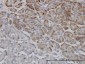 TRIM36 Antibody (monoclonal) (M01)