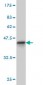 TRIM36 Antibody (monoclonal) (M01)