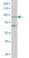 TRIM36 Antibody (monoclonal) (M01)