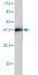 TRIM37 Antibody (monoclonal) (M01)