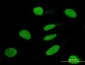 TRIM63 Antibody (monoclonal) (M01)