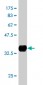 TROVE2 Antibody (monoclonal) (M01)