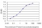 TROVE2 Antibody (monoclonal) (M03)