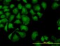 TROVE2 Antibody (monoclonal) (M03)