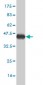 TROVE2 Antibody (monoclonal) (M03)