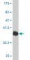 TRPV1 Antibody (monoclonal) (M01)