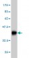 TRPV5 Antibody (monoclonal) (M02)