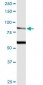 TRPV5 Antibody (monoclonal) (M02)