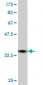 TRPV5 Antibody (monoclonal) (M06)