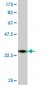 TRPV5 Antibody (monoclonal) (M06)
