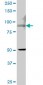 TRPV5 Antibody (monoclonal) (M06)